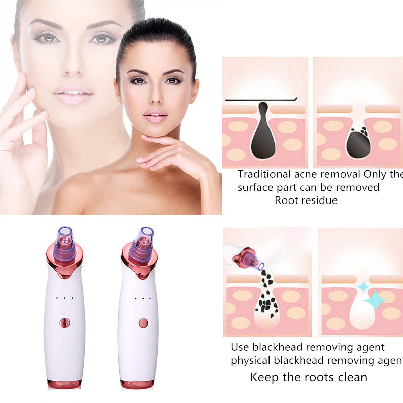 Blackhead Remover Instrument Black Dot Remover Acne Vacuum Suction Face Clean Black Head Pore Cleaning Beauty Skin Care Tool - kmtell.com