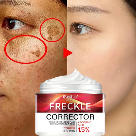 Hot Powerful Whitening Cream Skin Care Remove Freckle Melasma Dark Spots Corrector Lighten Melanin Pigmentation Brighten Product